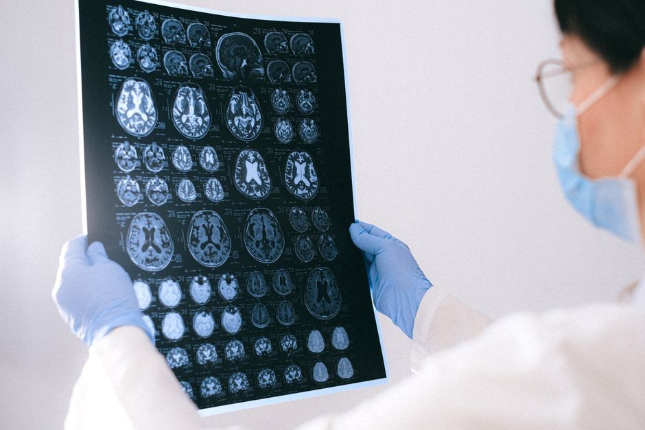 Seorang profesional medis sedang meninjau hasil MRI otak di lingkungan klinis, menyoroti teknologi kesehatan.