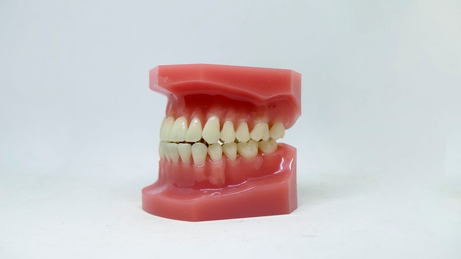 Model gigi yang menunjukkan gigi manusia digunakan untuk tujuan ortodontik di latar belakang putih.