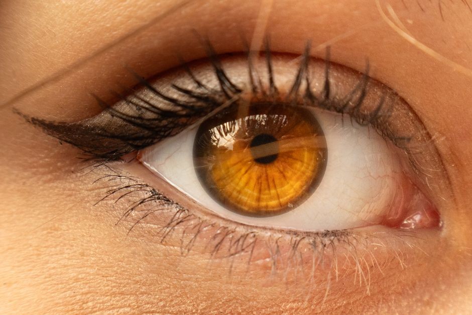 Lensa kontak atau softlens transparan yang menempel tipis di atas bola mata